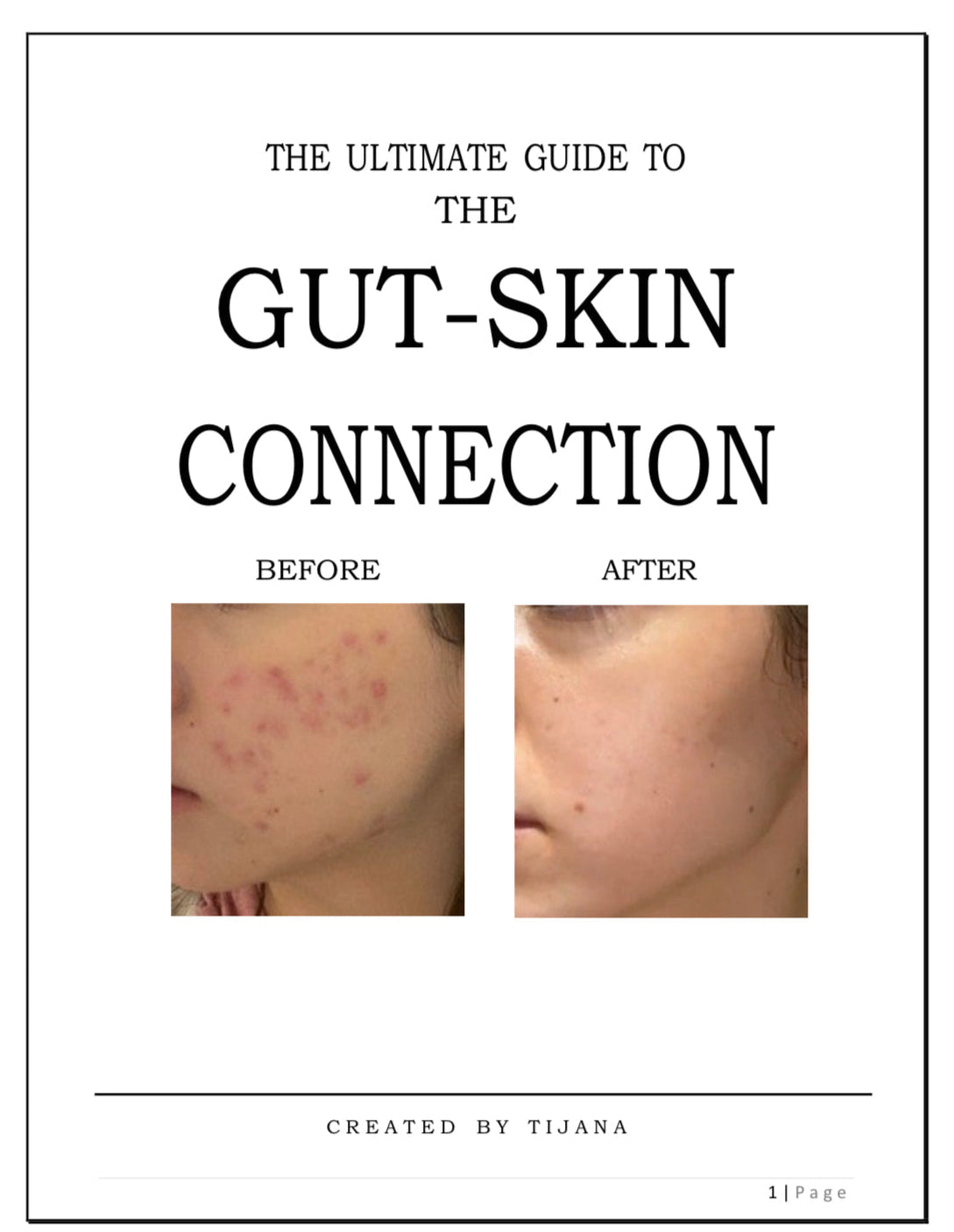 The Ultimate Guide To The Gut-Skin Connection
